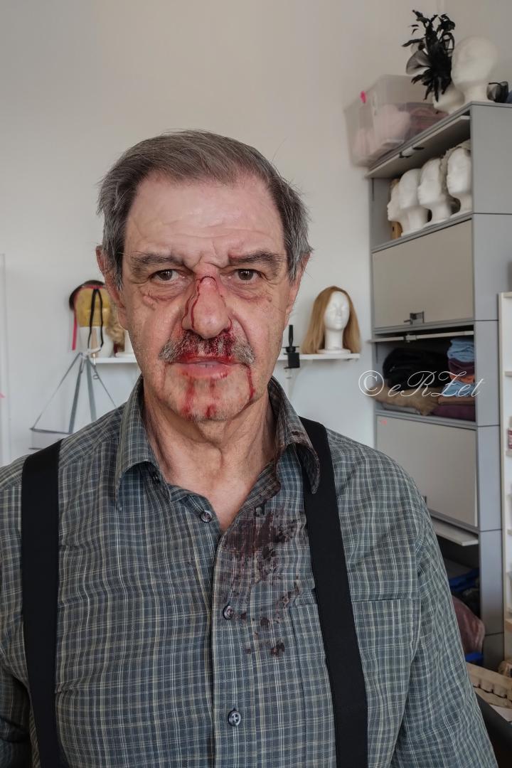 Ako som si strihol pacienta v „Dunaji“